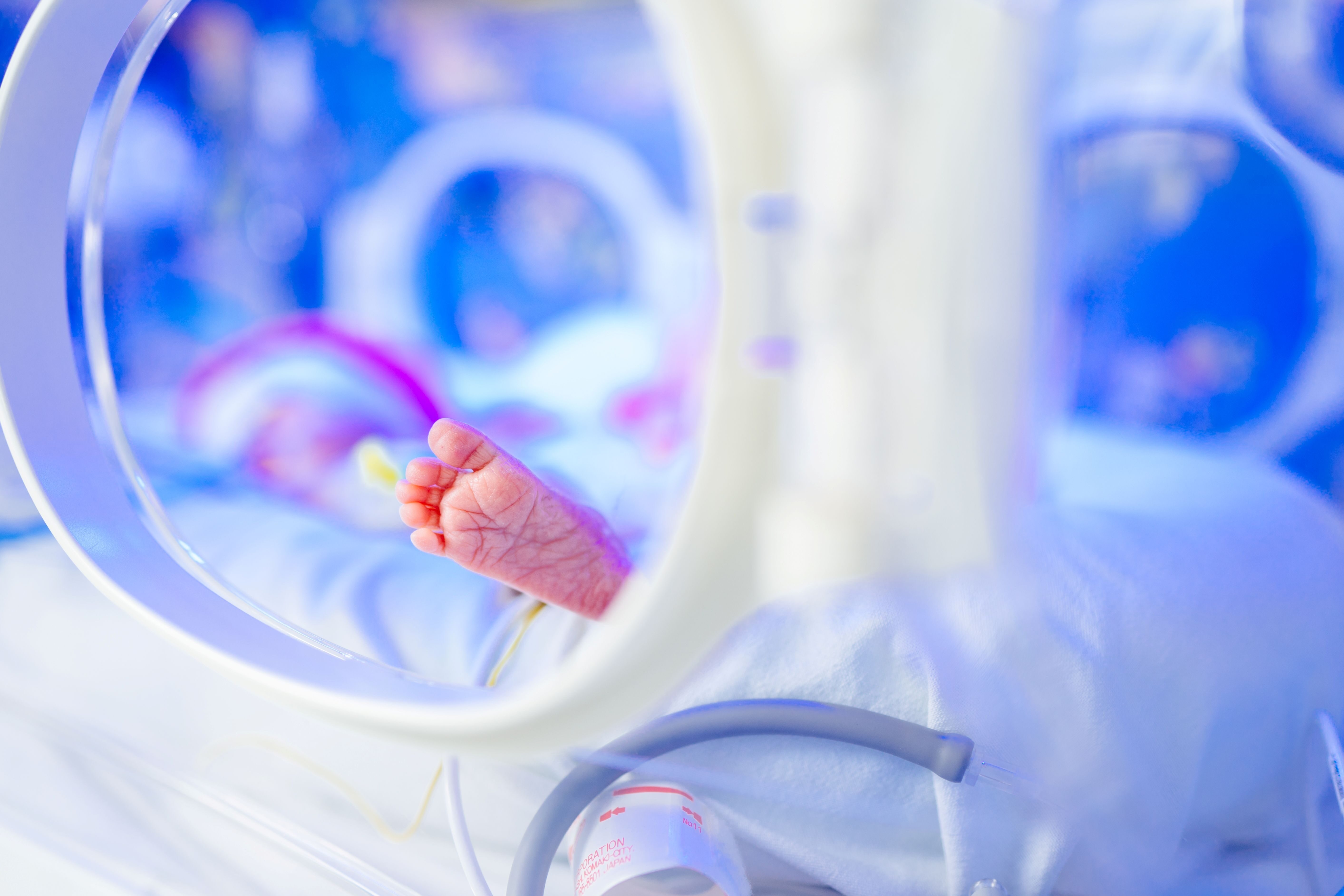 What is the NICU? A Parent's Guide to Neonatal Intensive Care